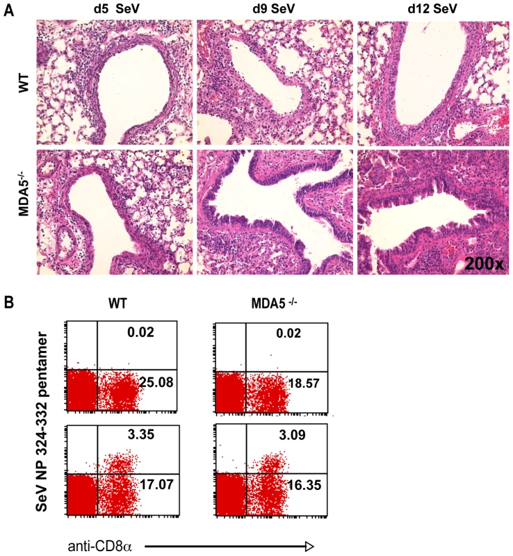 Increased histopathology in MDA5<sup>−/−</sup> mice.