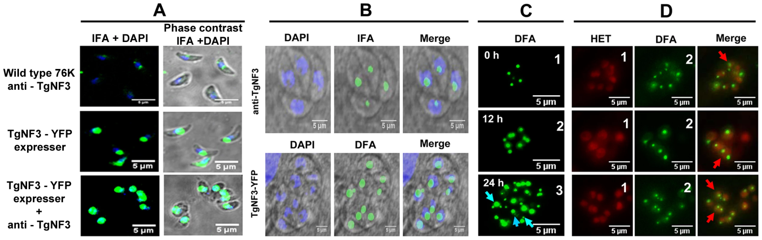 Native TgNF3 and transgenic TgNF3-YFP proteins are preponderant nucleolar resident factors.