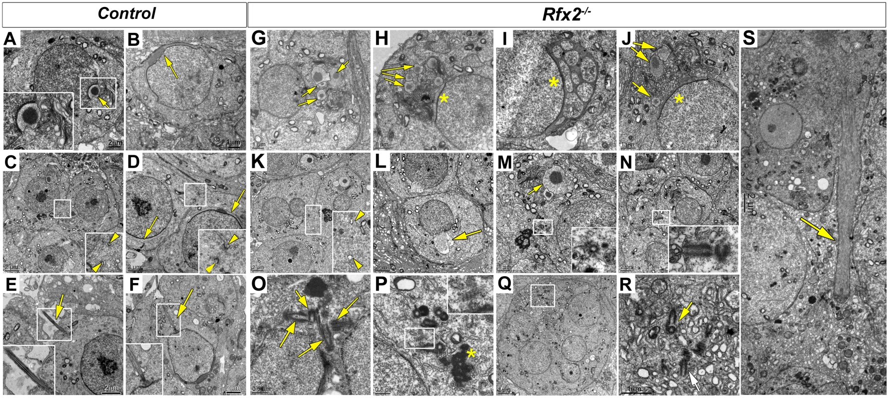 Ultrastructural defects and perturbed Golgi organization in <i>Rfx2</i><sup><i>-/-</i></sup> testes.