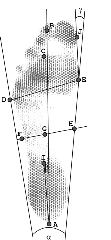 Morfologické body označované na chodidle a základní úhlové a délkové parametry.
Legenda: A – nejproximálněji položený bod, střed druhého prstu, nejdistálněji položený bod předonoží, D – nejlaterálněji položený bod předonoží, E – nejmediálnější bod přednoží na hlavičce I. metatarzu, F – laterálně položený bod v nejužším místě středonoží kolmém na laterální tečnu nohy, G – mediálně položený bod v nejužším místě středonoží kolmém na laterální tečnu nohy, H – průsečík kolmice v nejužším místě středonoží a mediální tečny nohy, I – nejdistálněji položený bod zánoží, J – nejmediálněji položený bod na palci, α – úhel nohy, β – úhel paty, γ – úhel palce (kladná hodnota úhlu signalizuje valgózní postavení palce, záporná virózní), |AC| - délka nohy bez prstů, |DE| - nejširší místo nohy, |FG| - nejužší místo nohy.