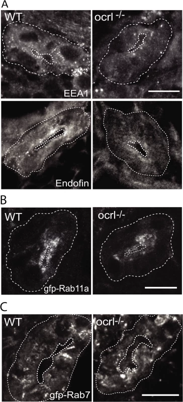 Reduced endosomal staining in OCRL1 deficient pronephros.