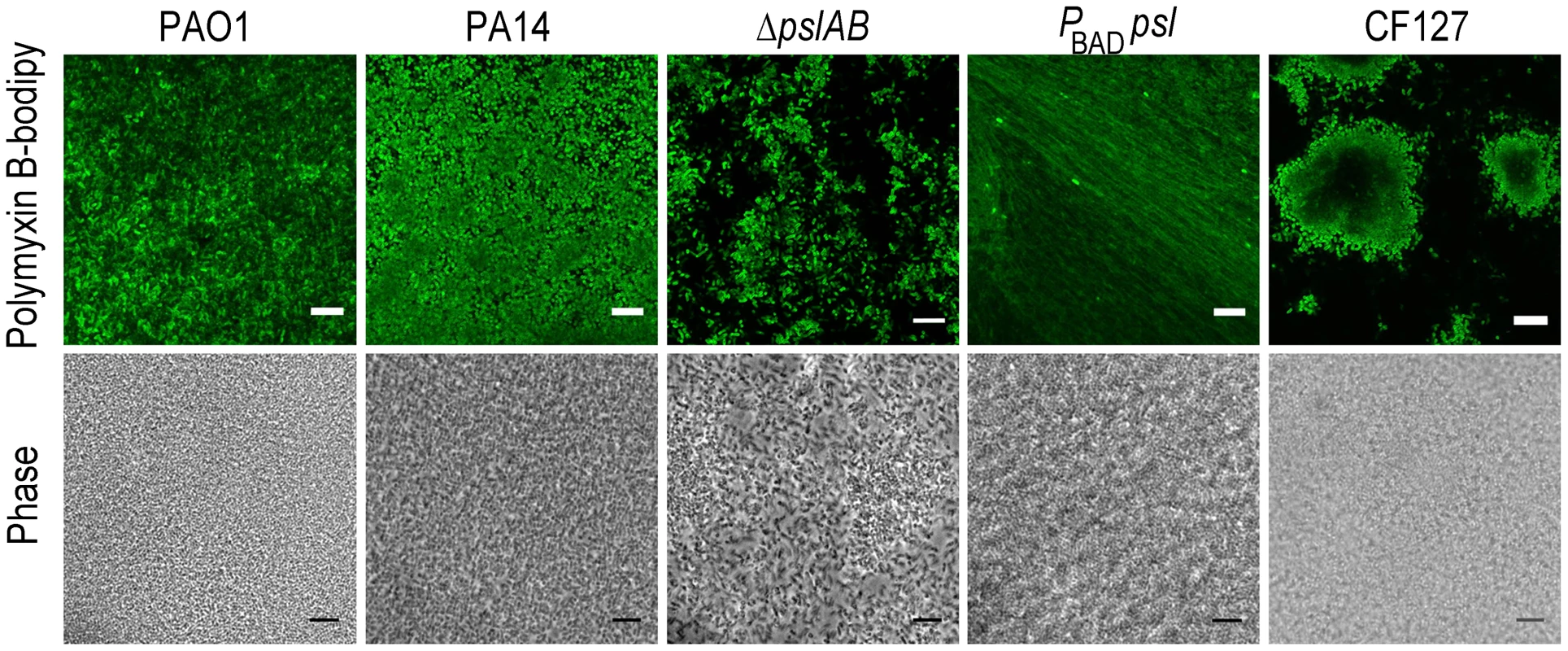Polymyxin B interacts with the Psl extracellular matrix.