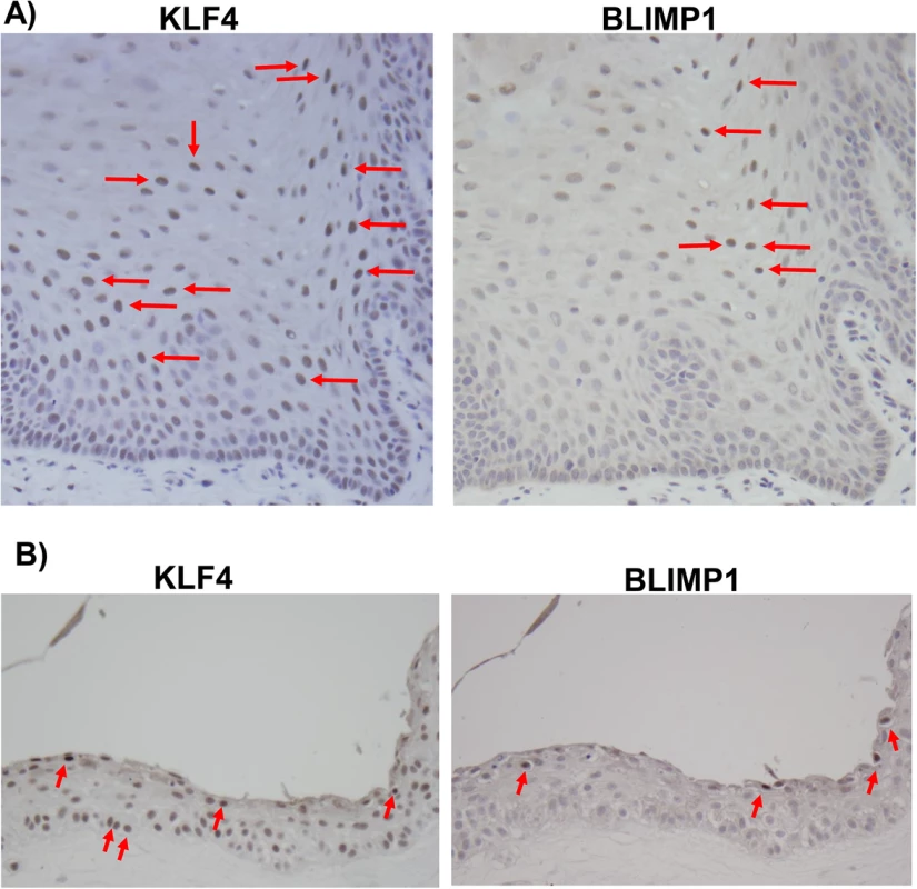 KLF4 and BLIMP1 expression is differentiation-dependent in normal tongue tissue.