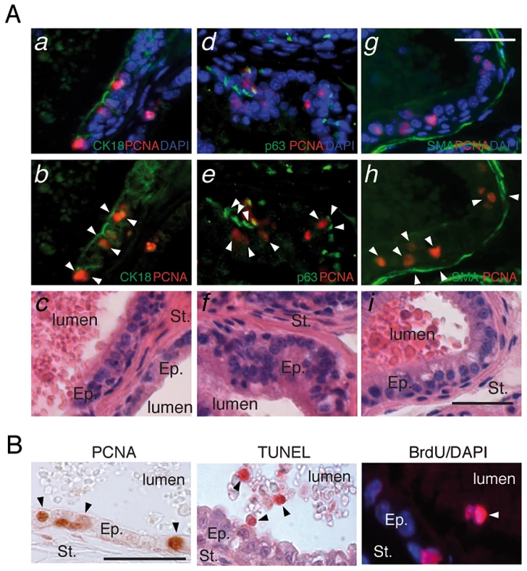 LXR null mice exhibit aberrant epithelial cell renewal.