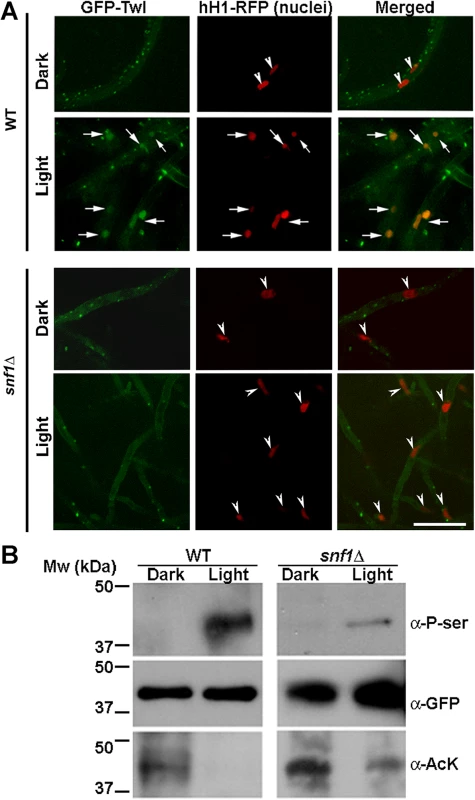 Snf1 kinase dependent phosphorylation drives the translocation of GFP-Twl into the nucleus in response to phototropic cues.