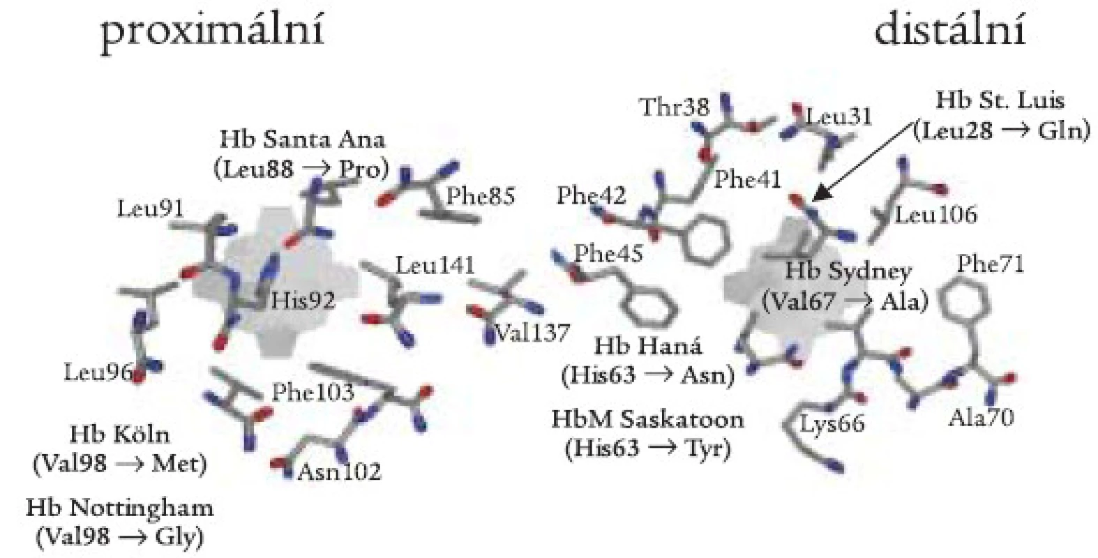 Proximální a distální strana hemové kapsy se schematickým znázorněním aminokyselinových záměn β-globinové podjednotky zjištěných v české a slovenské populaci.