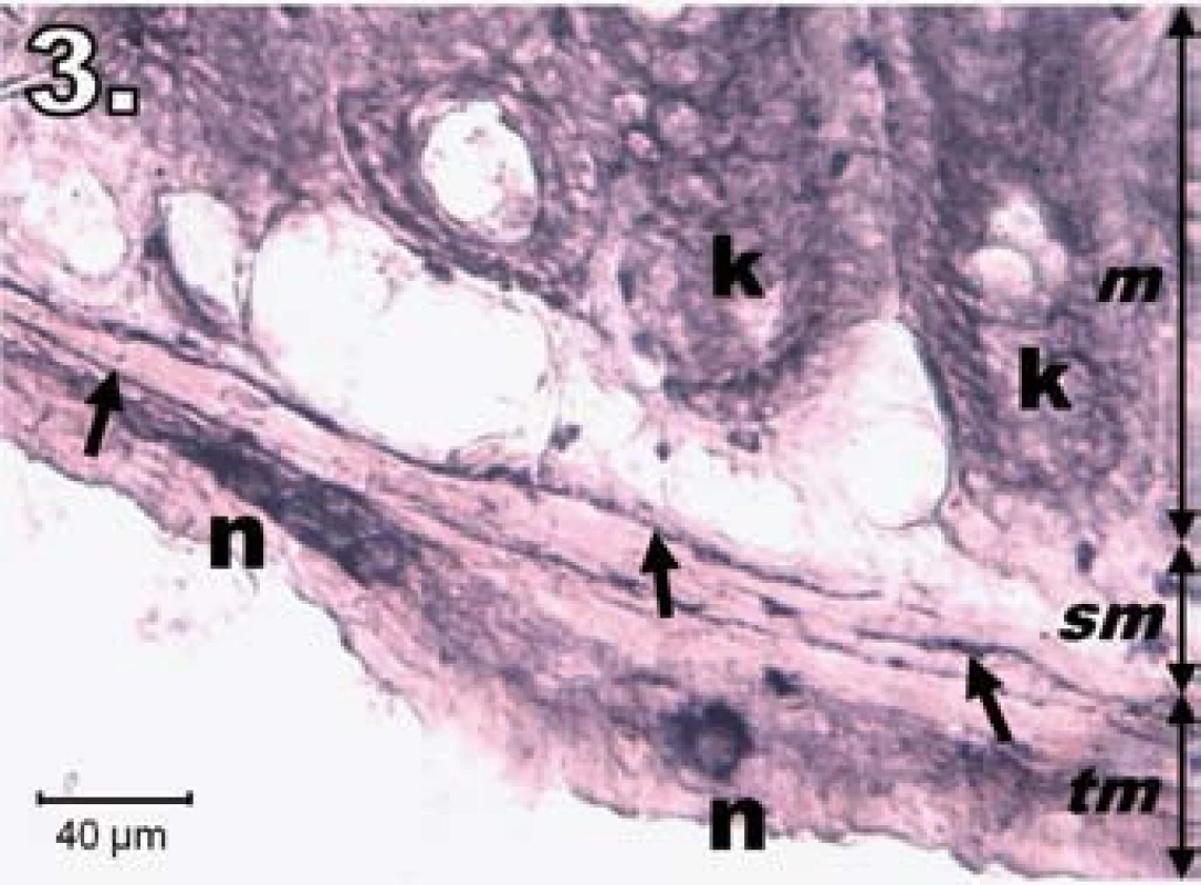 Histologický obraz jejuna v skupine R24. n – regenerujúce sa NADPH-d pozitívne neuróny, šípky – nervové vlákna, k – negatívne Lieberkühnove krypty, m – mukóza, sm – submukóza, tm – tunica muscularis; scale bar = 40 μm
Fig. 3. Histological picture of jejunum in group R24. n – regeneration in NADPH-d positive neurons, arrows – nerve fibres, k – negativity in Lieberkühn's crypts, m – mucosa, sm – submucosal layer, tm – tunica muscularis; scale bar = 40 μm