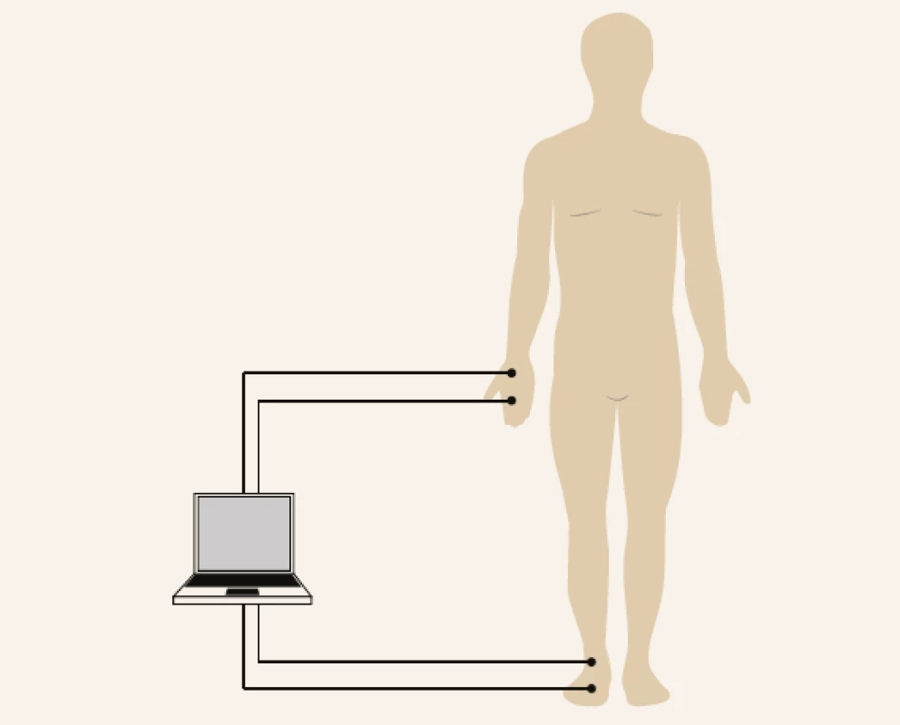 Two electrodes are placed on the right hand
and foot for bioimpedance measurement.<br>
Modified according to [13]
