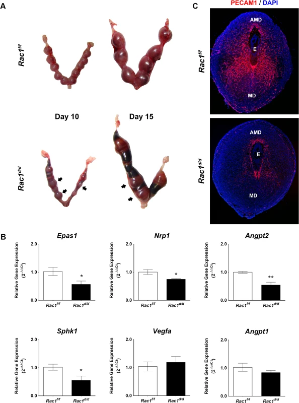 Pregnancy failure in <i>Rac</i>1<sup><i>d/d</i></sup> mice in mid gestation is associated with lack of angiogenesis.
