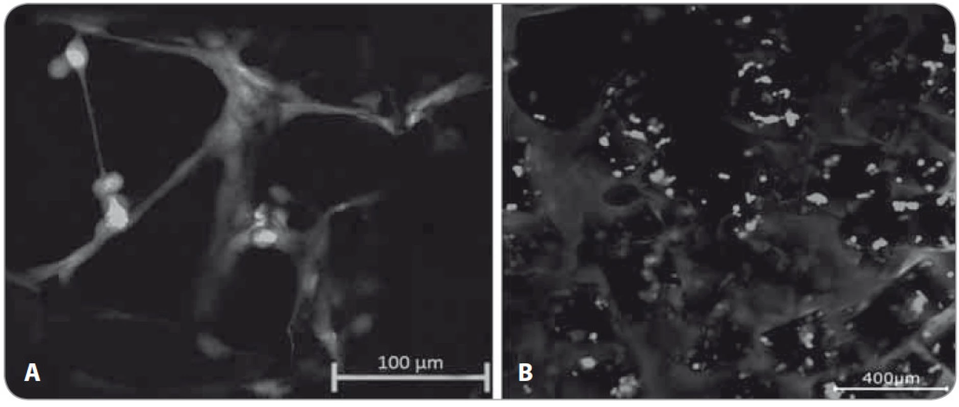 Snímky z konfokálního mikroskopu p(HEMA-co-AEMA)-RGD scaff oldu, d = 350–450 μm po inkubaci s HS-5 buňkami (A, B).