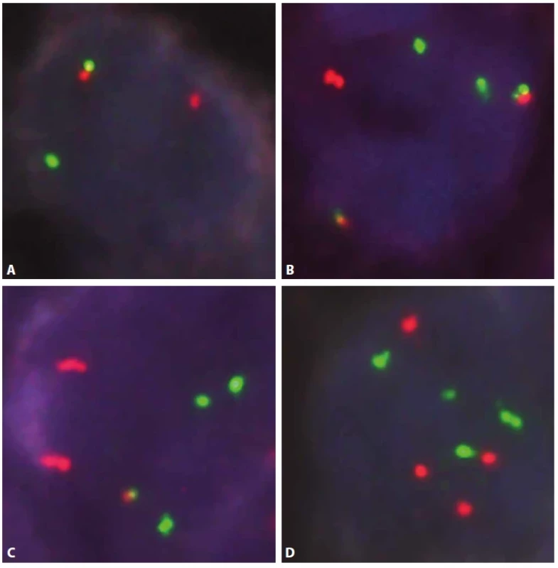 Fluorescenční in situ hybridizace – jádra buněk komponenty FL.