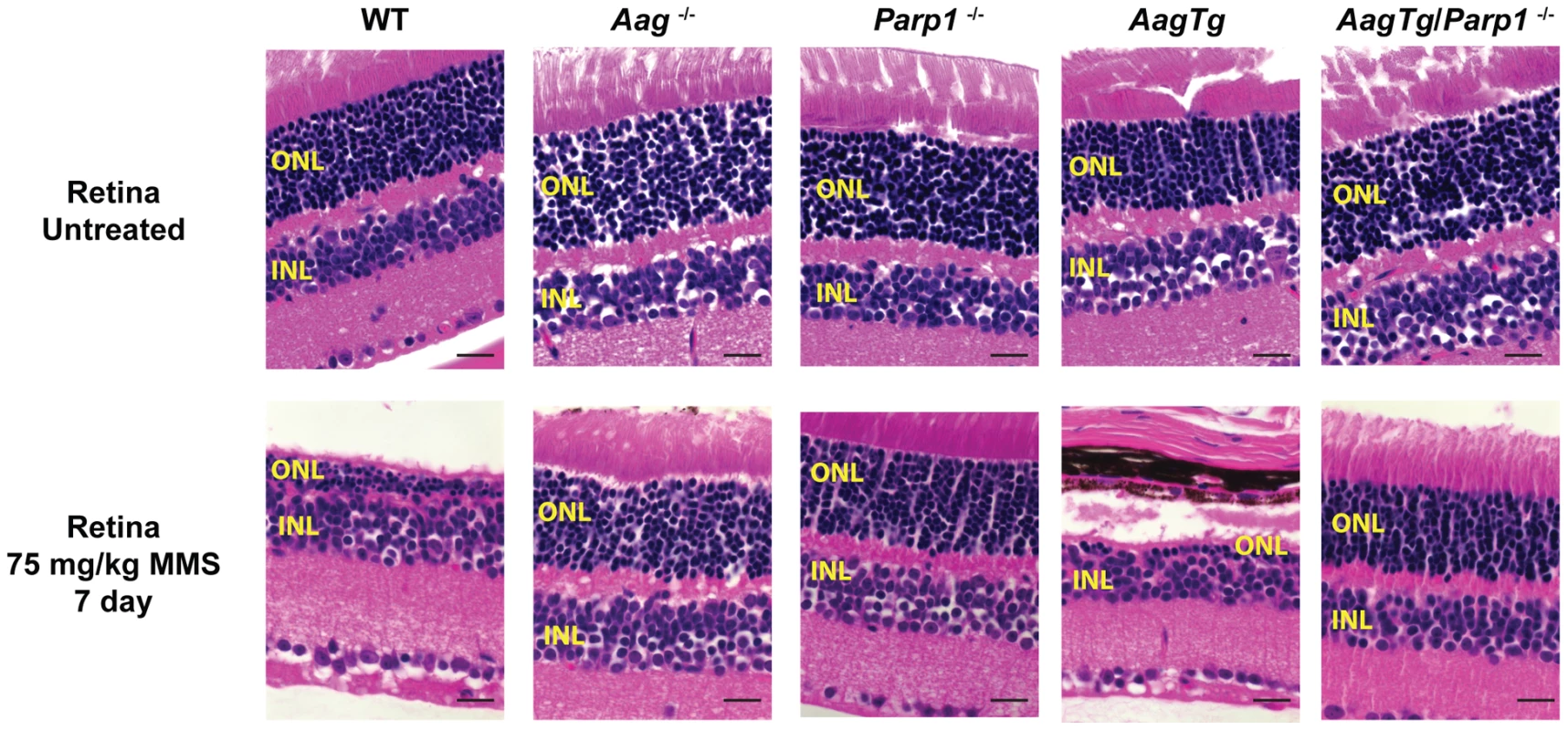 Parp1 deficiency protects against Aag-dependent, MMS-induced toxicity in retina photoreceptors.