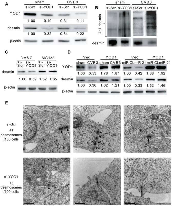 YOD1 regulates desmin degradation during CVB3 infection.