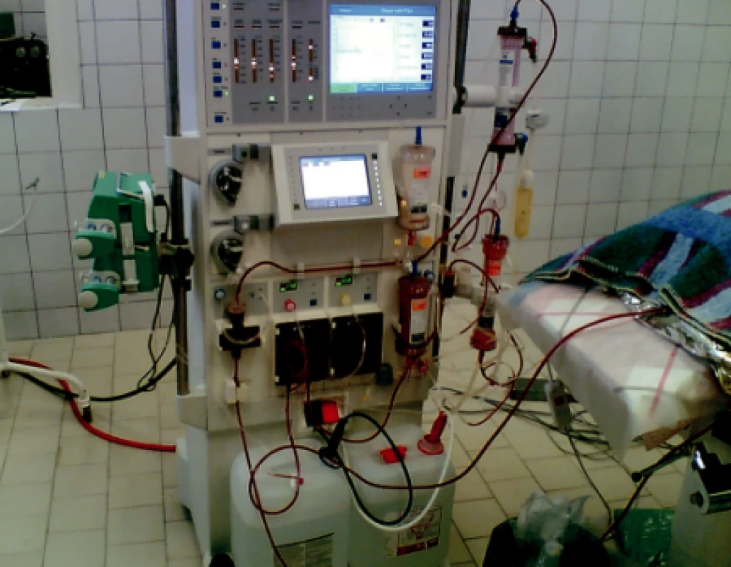 Přístroj Prometheus napojený na krevní oběh laboratorního zvířete s ASJ