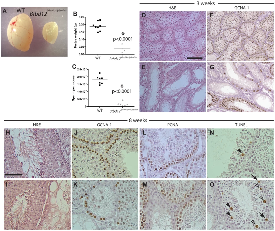 <i>Btbd12<sup>βGeoFlox/βGeoFlox</sup></i> mutants have reduced testicular germ cell proliferation.