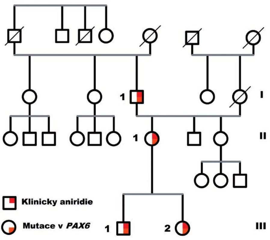 Rodokmen rodiny s izolovanou kongenitální aniridií a PAX6 mutací.