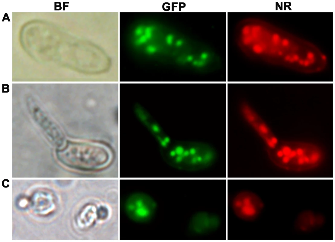 Intracellular localization of MEST1 in <i>Metarhizium robertsii</i> Mr2575 and budding yeast <i>Saccharomyces cerevisiae</i>.