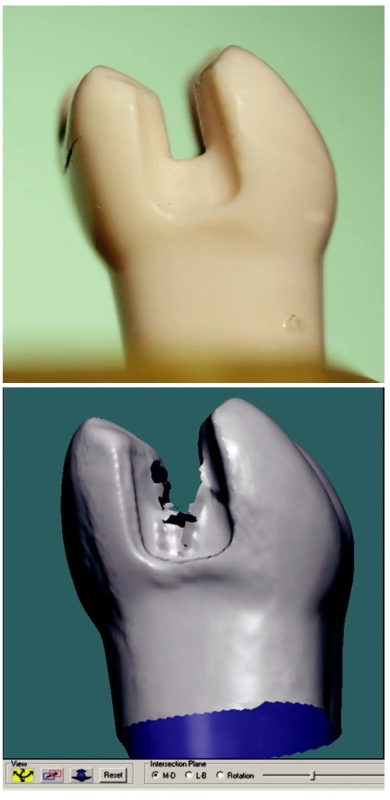 a) Zub 36 - MD pohled.
b) Artefakt - roztřepení okraje.