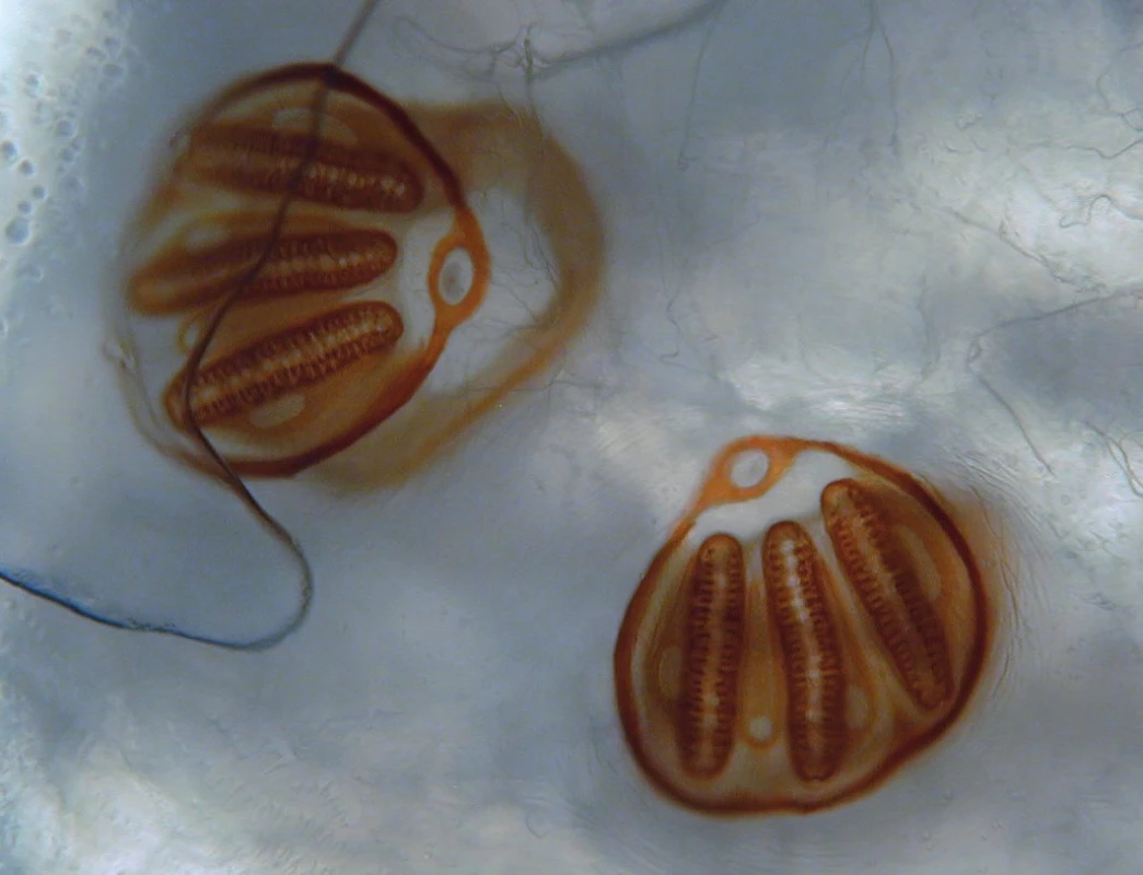 Mikroskopický pohled na původce externí oční myiázy – larvu z čeledi Calliphoridae