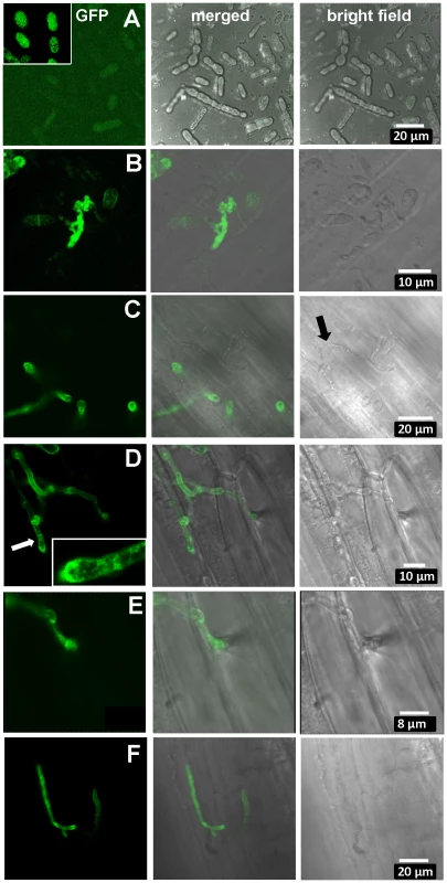 Expression of UhAVR1:GFP chimers during infection.