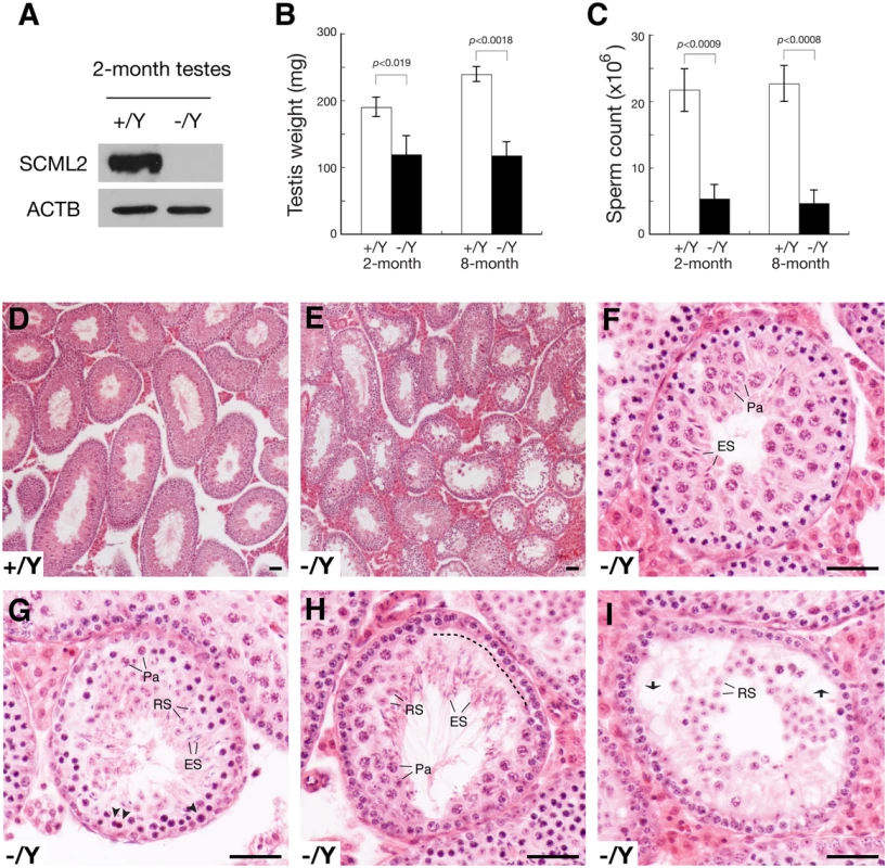 Defective spermatogenesis in <i>Scml2</i><sup>-/Y</sup> mice.