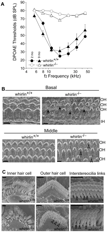 Whirlin knockout mice have non-progressive hearing defects.