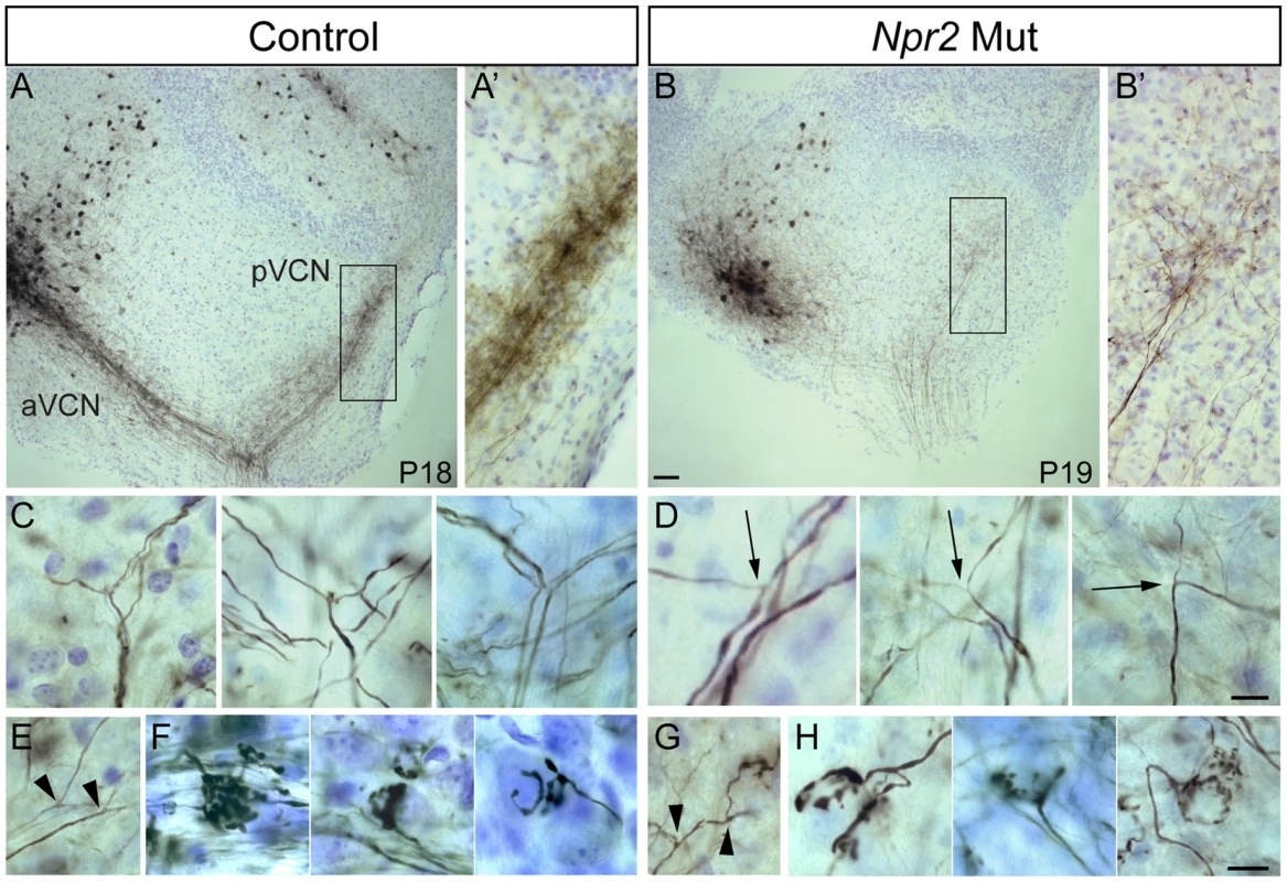 <i>Npr2</i> mutant SGN axons do not bifurcate properly but can form interstitial branches and morphologically normal synapses.