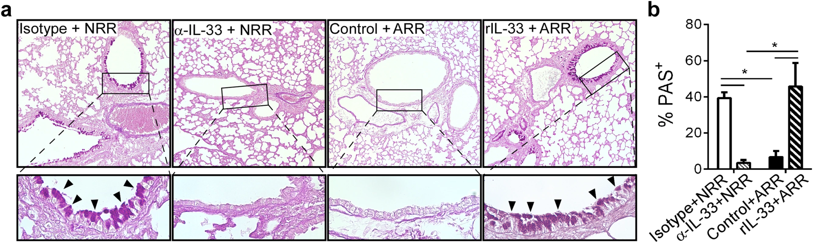 IL-33 levels during primary RSV infection determine disease severity after reinfection.