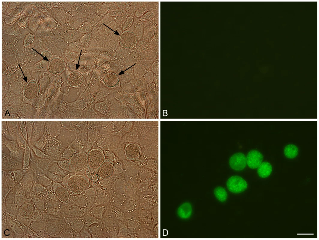 Green fluorescent inclusions in McCoy cells infected with <i>C. trachomatis</i> L2/434/Bu transformed with pGFP::SW2.