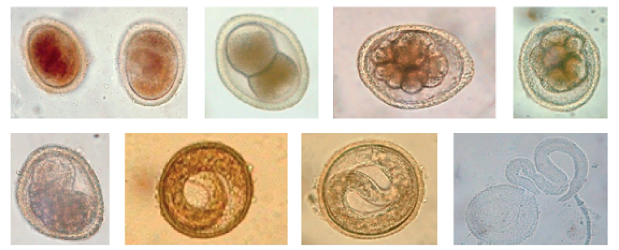 Vývoj larvy &lt;i&gt;Toxocara canis&lt;/i&gt; (foto Mgr. Bílková Fránková a MVDr. Romana Mašková)
