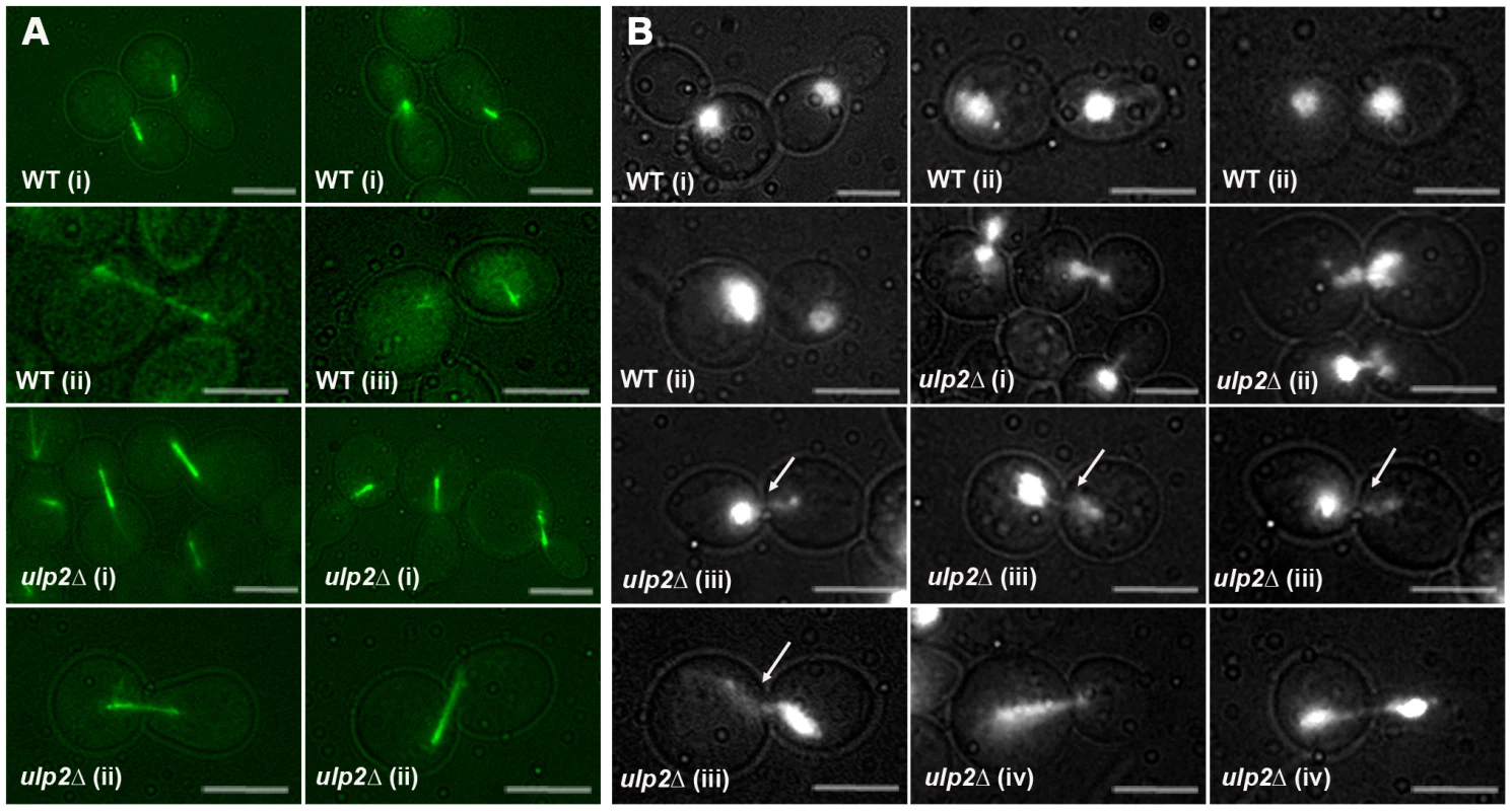 Chromosome segregation failure in MMS–treated <i>ulp2</i>Δ <b>mutants.</b>