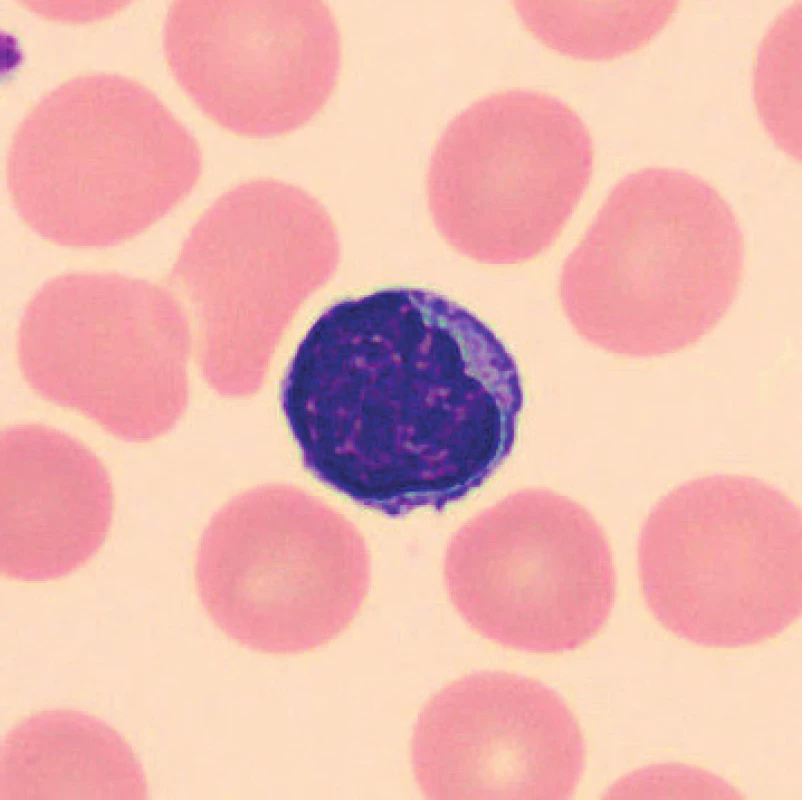 Lymfocyt (6 hodin po odběru, laboratorní teplota)