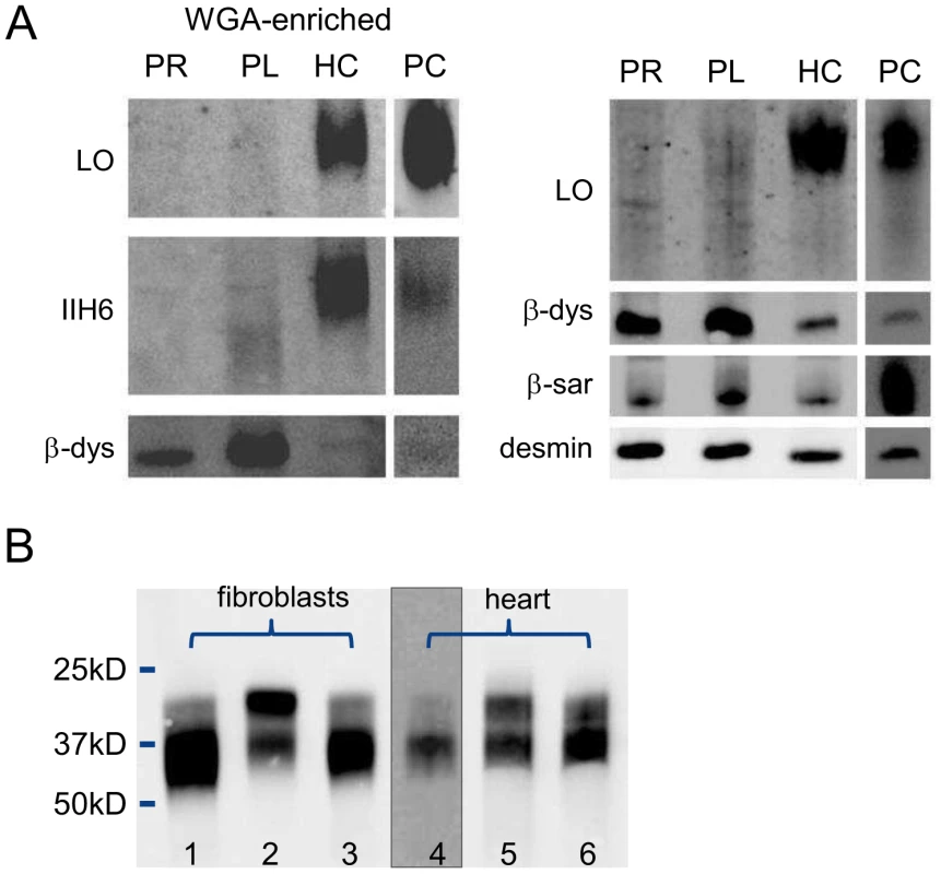 Western blotting for analysis of O-mannosylation and N-glycosylation.