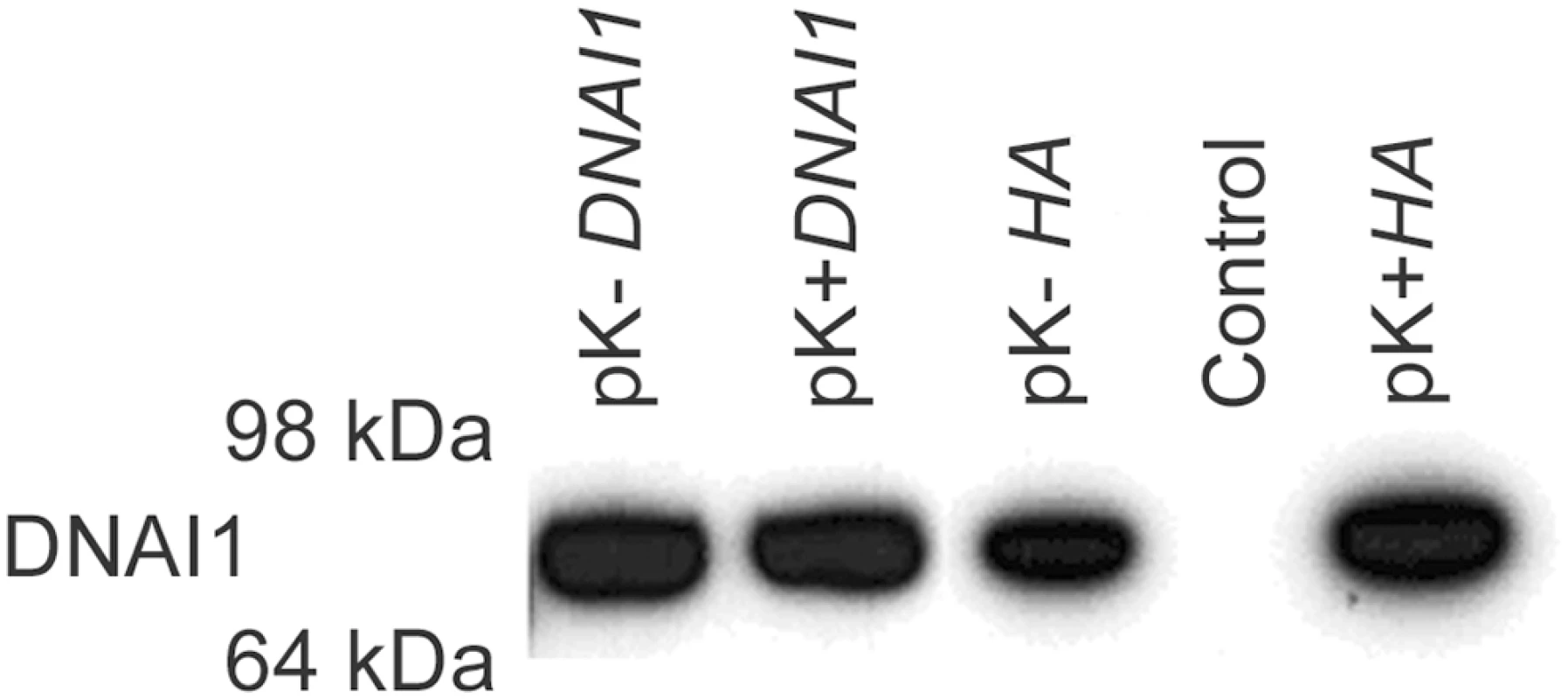 DNAI1 protein detection with the use of DNAI1 anti-dyn69 antibody.