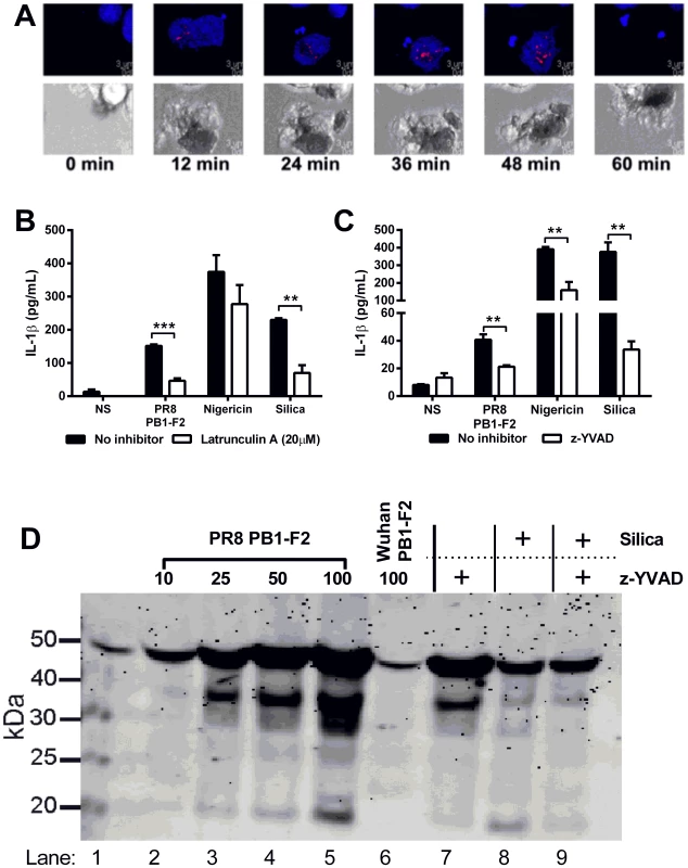 PR8 PB1-F2-mediated inflammation is NLRP3-, Caspase 1- and phagocytosis- dependent and induces ASC speck formation in macrophages.