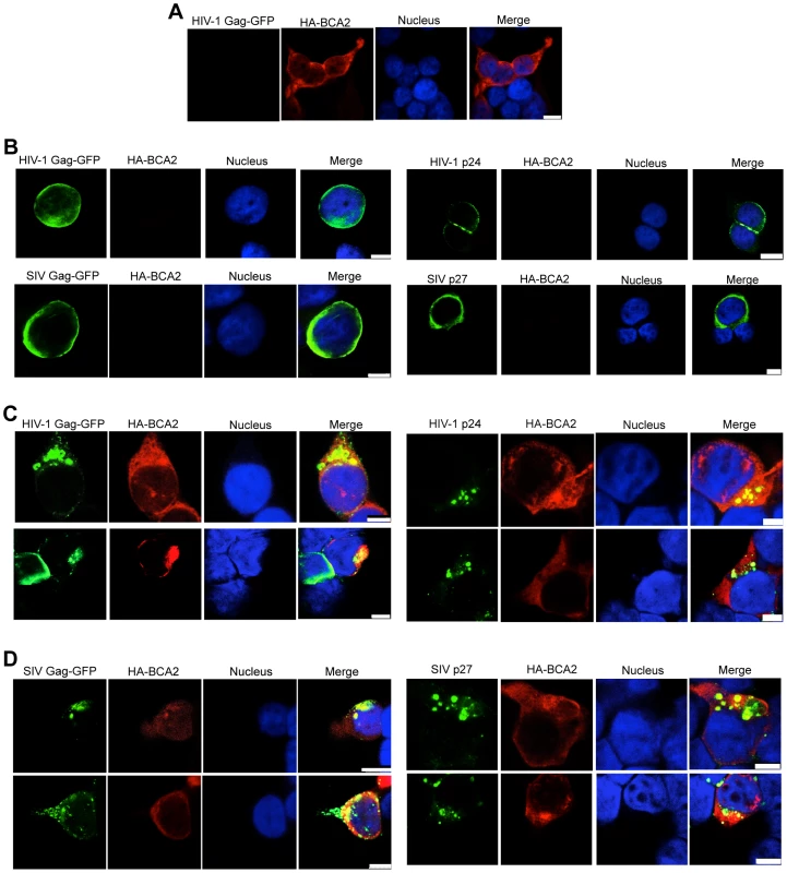 BCA2 leads to the accumulation of Gag proteins within intracellular compartments.