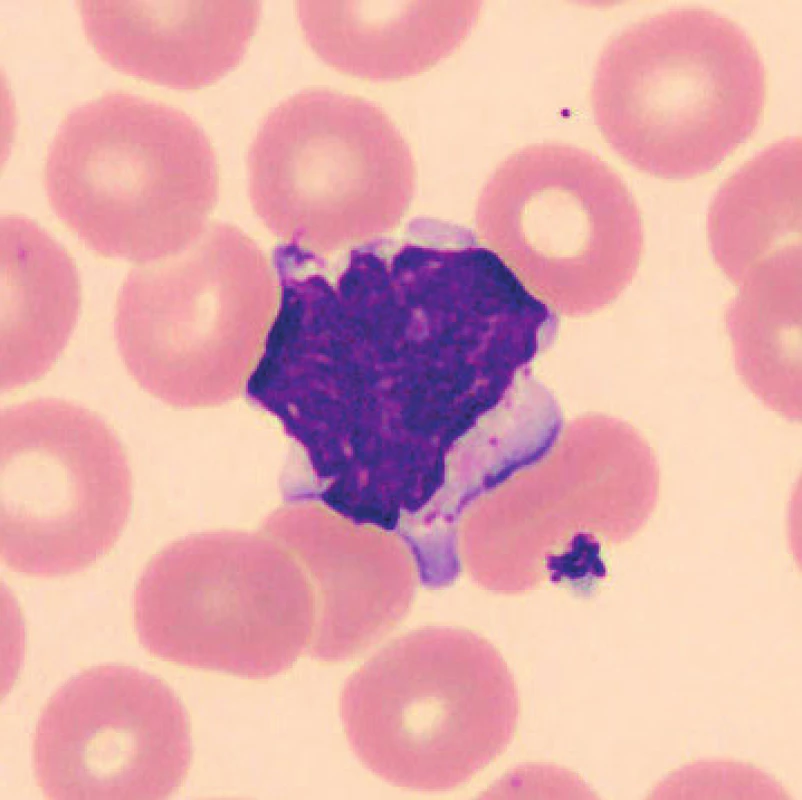 Lymfocyt (24 hodin po odběru, laboratorní teplota)