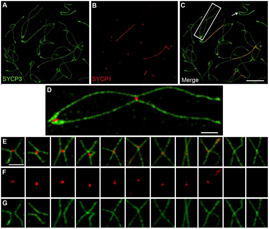 Axis remodeling revealed by structured illumination microscopy of diplotene-stage spermatocytes.