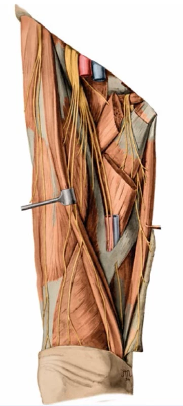 Rekonstrukce předchozího obrazu provedená I. Helekalem v roce 2014 pro současný anatomický atlas