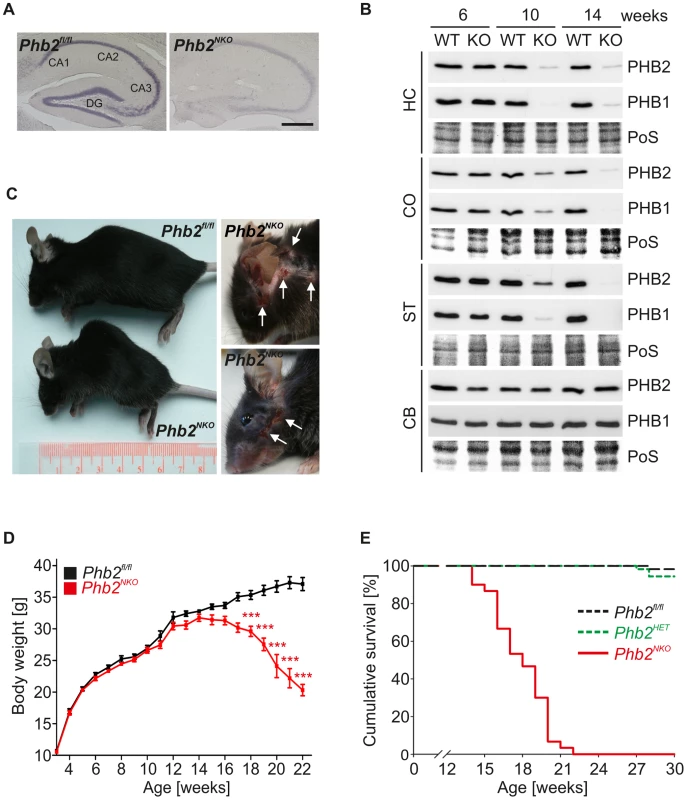<i>CaMKIIa-Cre</i>-mediated inactivation of the mouse <i>Phb2</i> gene in forebrain neurons.