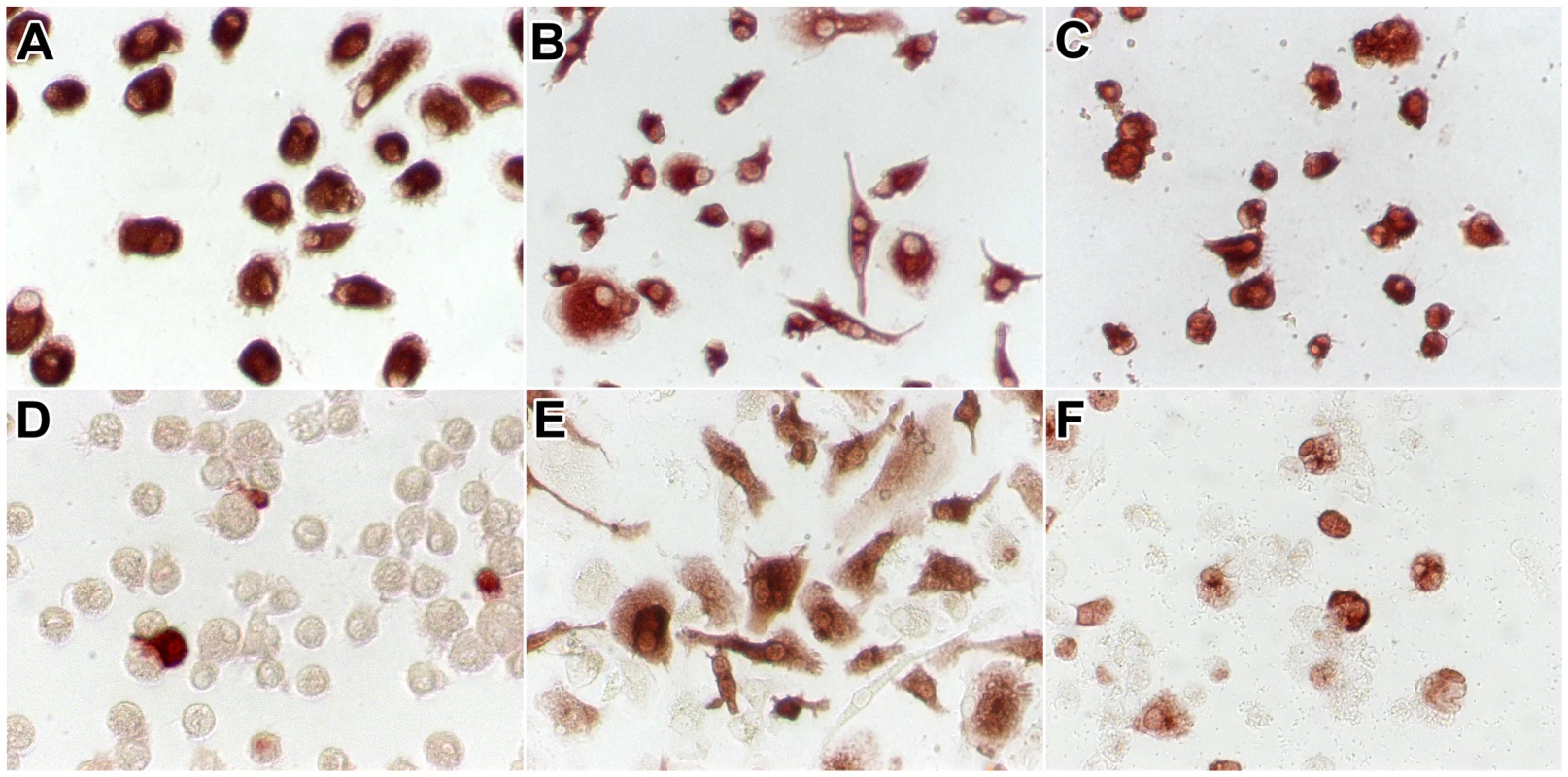 CD68 and influenza A virus antigen expression in alveolar macrophages and macrophages cultured from monocytes.
