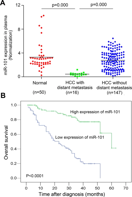 Analysis of miR-101 levels in human plasma samples by real-time PCR and Kaplan-Meier analysis for HCC patients DFS according to the plasma levels of miR-101.