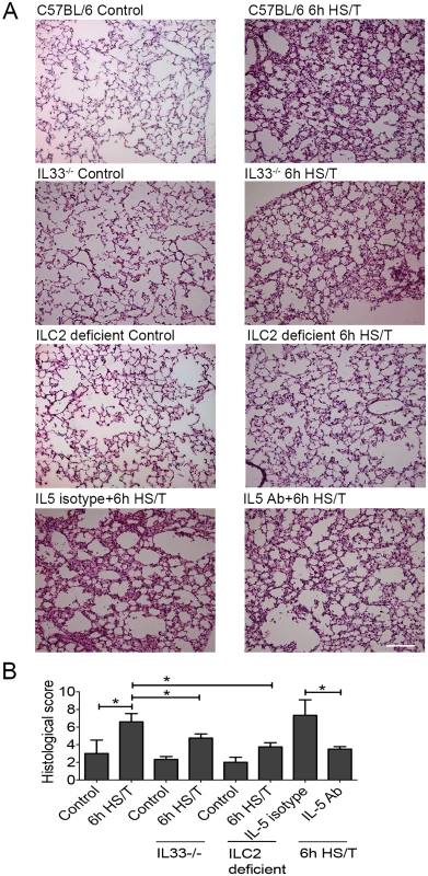 Effects of interleukin (IL) 33 deletion, ILC2 deficiency, and IL5 neutralization on lung injury after resuscitated hemorrhagic shock and tissue trauma (HS/T).