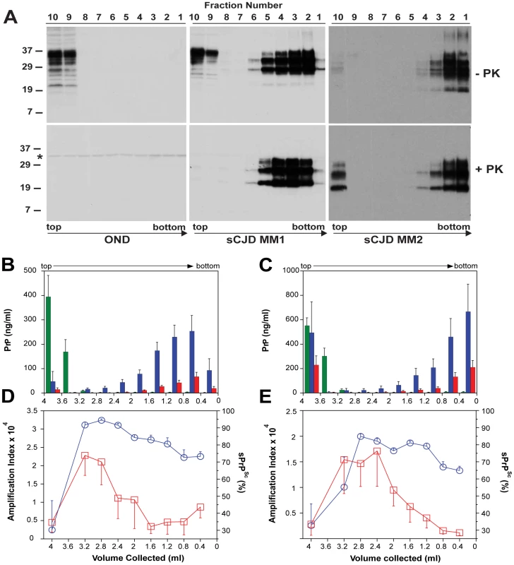 Sedimentation velocity, amplification index, and protease sensitivity of PrP<sup>Sc</sup> present in frontal cortex of patients with sCJD Type MM1 (n = 6) and Type MM2 (n = 6) and fractionated by ultracentrifugation in sucrose gradient.