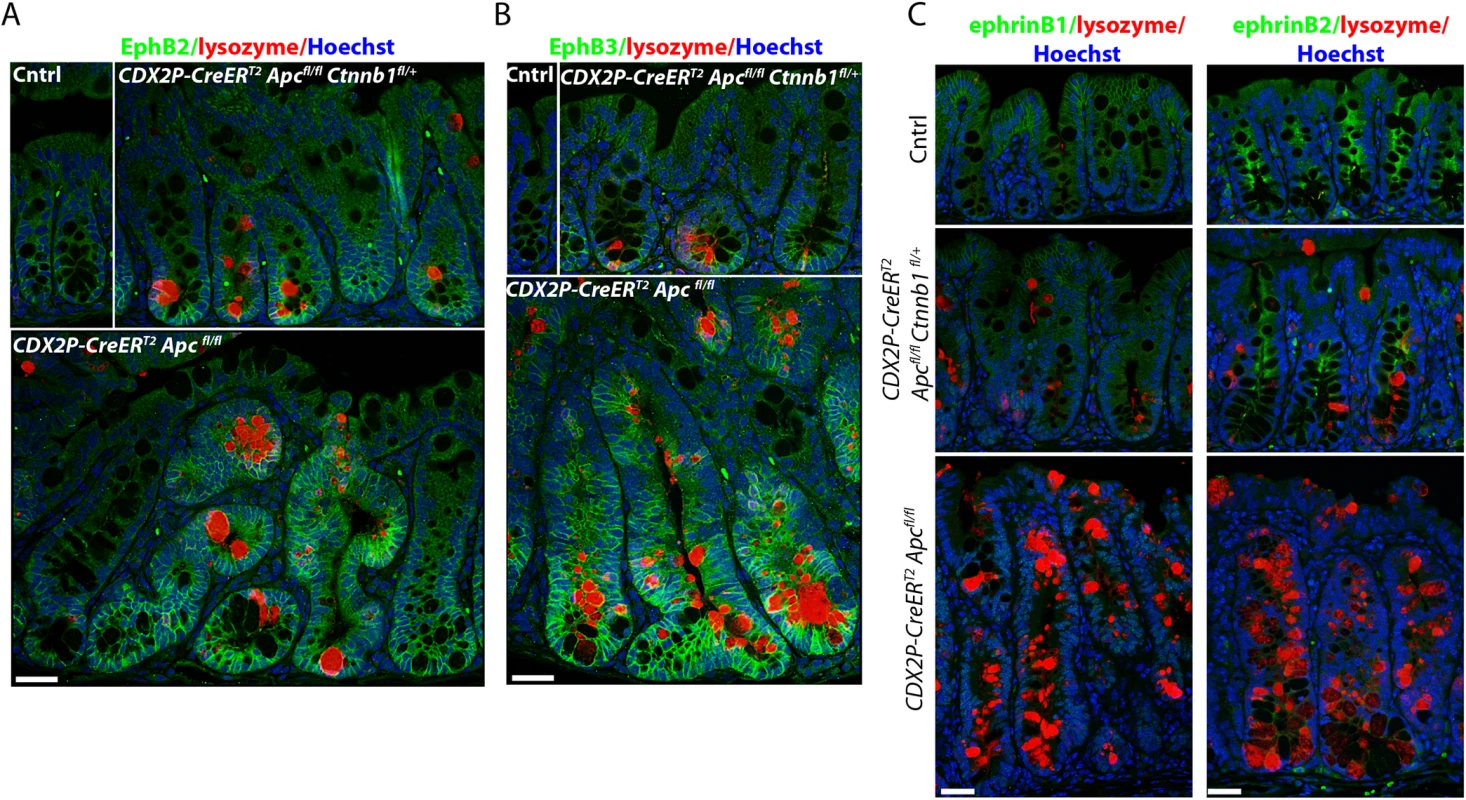 Inactivation of one <i>Ctnnb1</i> allele in <i>Apc</i>-mutant mouse colon epithelium preserves the compartmentalization of the EphB2/B3- and ephrinB1/B2-expressing cells to maintain crypt architecture.