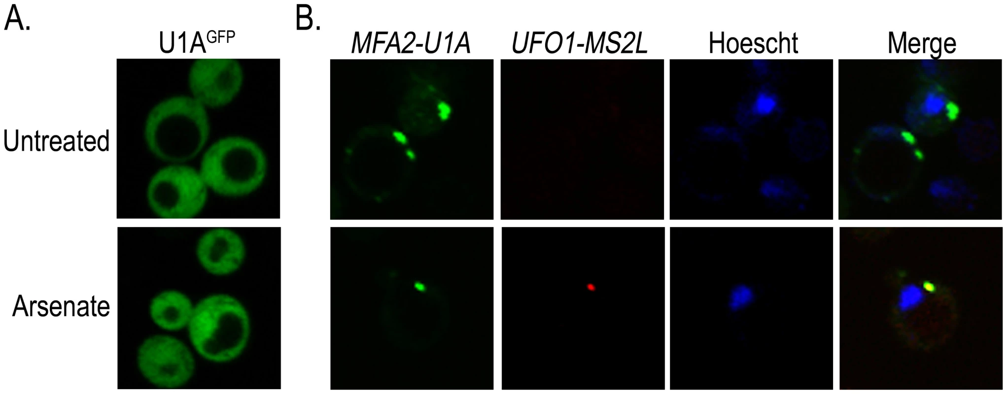 <i>UFO1-MS2L</i> and <i>MFA2-U1A</i> mRNAs are sequestered in the same PBs after arsenate stress.