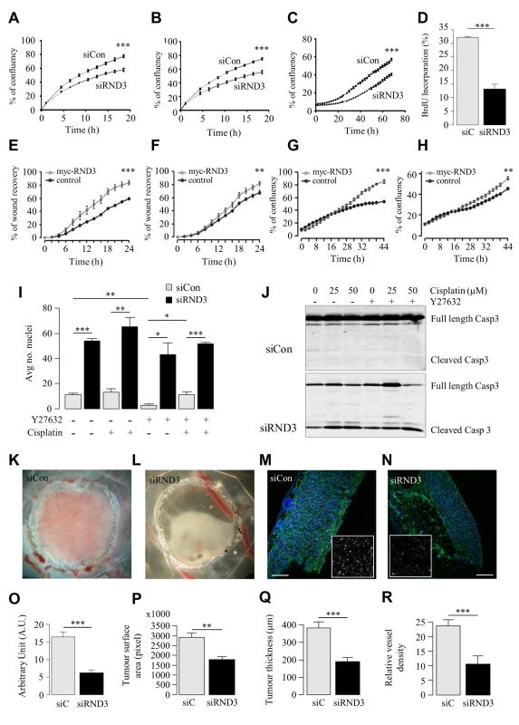 <i>In vitro</i> and <i>in vivo</i> RND3 silencing reduces cell proliferation and migration, induces apoptosis and reduces tumour mass.