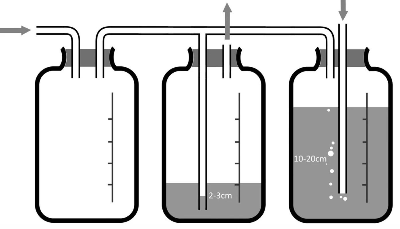 Systém pro balancovanou drenáž
Fig. 8: Balanced drainage system