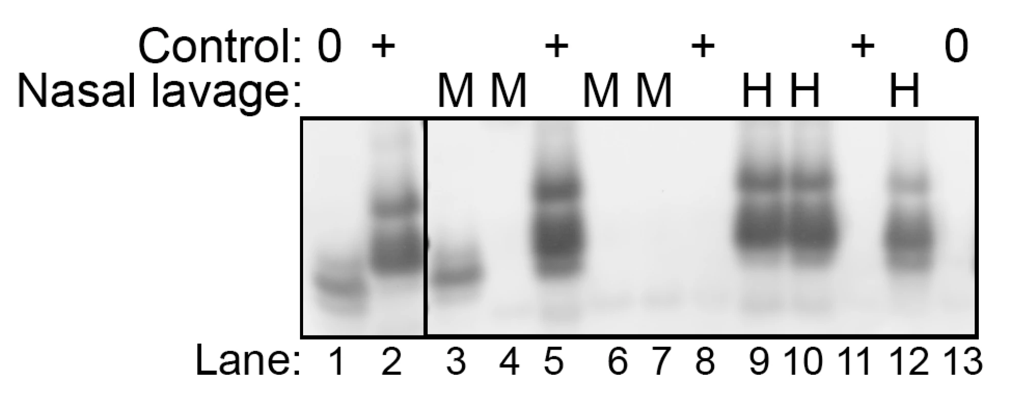 Western blot detection of HY TME infection in nasal lavages using the QuIC assay.