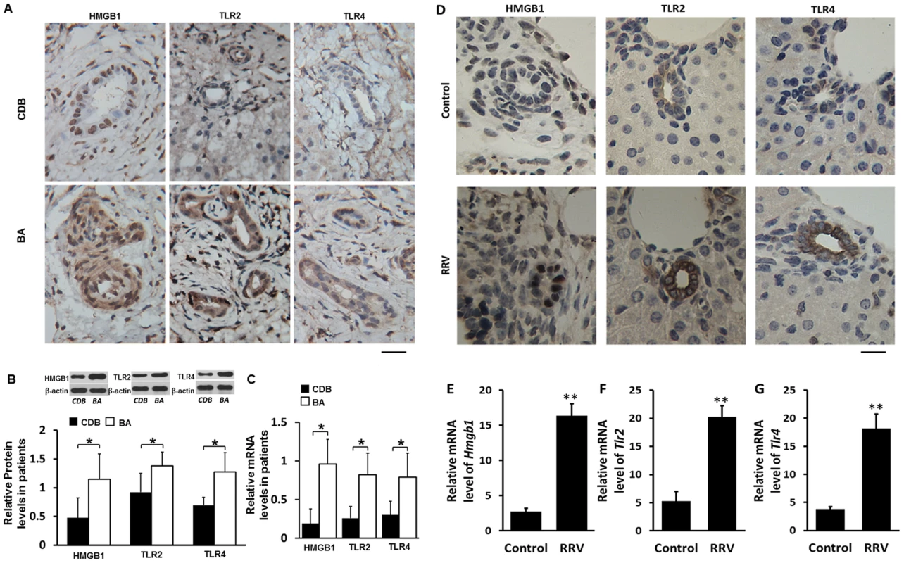 Expression of HMGB1, TLR2 and TLR4 in livers of infants with biliary atresia (BA) and in bile ducts of mice challenged with RRV.